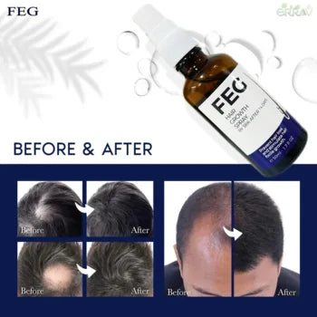 FEG Hair Growth Spray (Buy 1 Get 2 FREE)