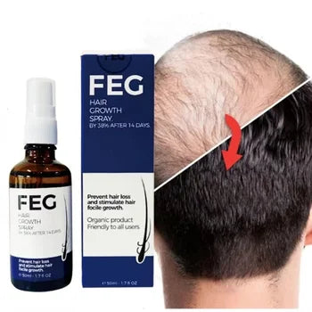 FEG Hair Growth Spray (Buy 1 Get 2 FREE)